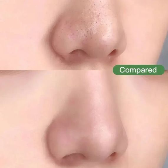 Маска для обличчя з маслом зеленого чаю проти чорних точок акне очищаюча Green Tea крем зволожуючий | Зображення 4