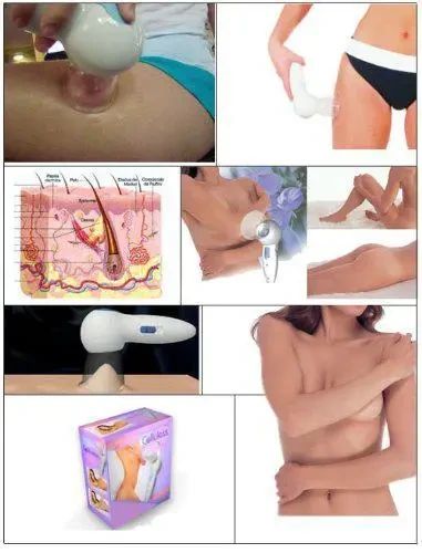 Вакуумный антицеллюлитный массажер Celluless | Зображення 5