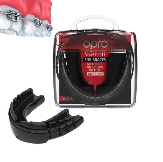 Капа боксерська OPRO Snap-Fit FOR BRACES Black (art.002318001) | Зображення 1