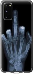Чехол на Samsung Galaxy S20 Рука через рентген из пластика FCh_062497