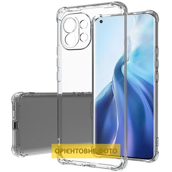 TPU чохол GETMAN Ease logo посилені кути Full Camera для Xiaomi 17 Безбарвний (прозорий) | Зображення 1