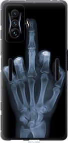 Чехол на Xiaomi Poco F4 GT Рука через рентген "1007u-2958-17620"