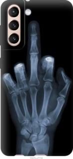 Чехол на Samsung Galaxy S21 Рука через рентген из пластика FCh_061923