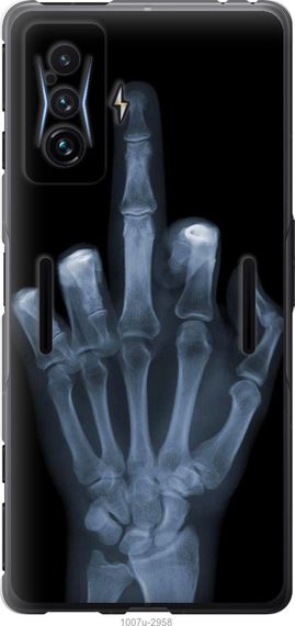 Чехол на Xiaomi Poco F4 GT Рука через рентген "1007u-2958-17620"