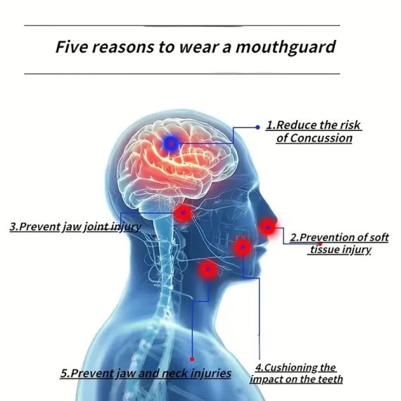 Капа VENUM для рота для баскетболу, регбі, боксу, карате, захист зубів і підтримка зубних брекетоа | Зображення 6