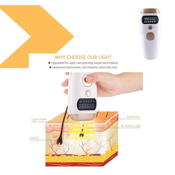 Портативний фотоепілятор з технологією IPL XPRO Hair Removal Device (46390-7997_481) | Зображення 1