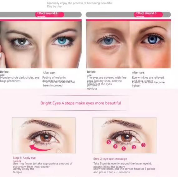 Электрический массажёр для глаз от морщин | Зображення 2