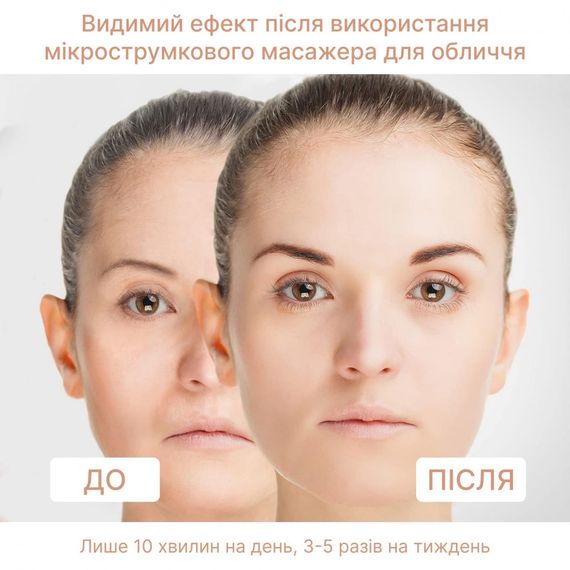 4EMS МИКРОТОК ЛИФТИНГ-МАССАЖЕР MEDICA+ SKIN LIFTING 6.0 WHITE гарантия 1 год | Зображення 1