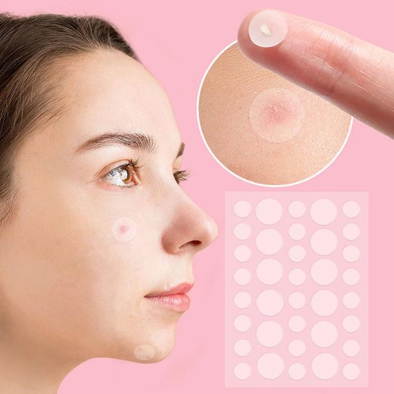 Патчі від прищів та акне 72 шт Acne Patch / Пластир косметичний для лікування акне | Зображення 1