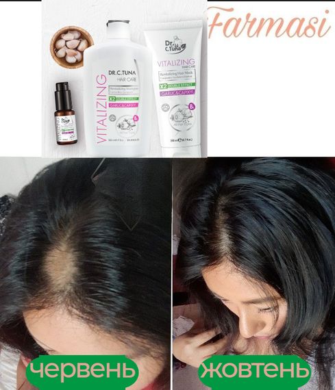 Набор против выпадения и укрепления волос (шампунь, маска, концентрат) Farmasi Vitalizing Dr. C.Tuna | Зображення 6