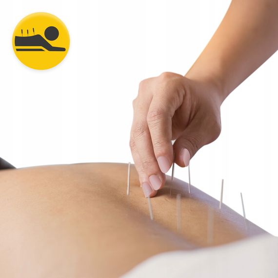 Голки акупунктурні 4FIZJO 0.25 х 30 мм з направляючою 100 шт (P-5905973405065) | Зображення 3