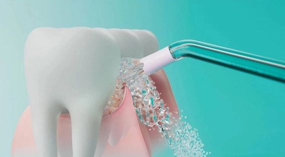 Іригатор Philips Sonicare HX3826/24 Power Flosser 3000 | Зображення 4