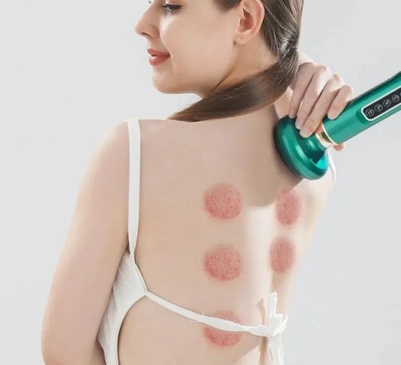 Вакуумний антицелюлітний масажер для тіла Cupping Massager для корекції фігури | Зображення 6