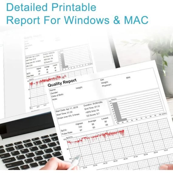 Пульсоксиметр ViATOM Checkme O2 Max з Bluetooth, кільцевий датчик, безперервний моніторинг SpO2 і пульсу, додаток Vihealth | Зображення 4