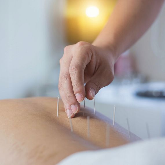 Иглы акупунктурные 4FIZJO 0.3 х 50 мм с направляющей 100 шт 4FJ0551 (P-5907739318954) | Зображення 4