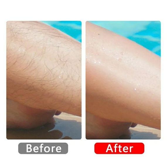 Кристалічний епілятор Nano для видалення волосся Crystal Hair Removal | Зображення 2