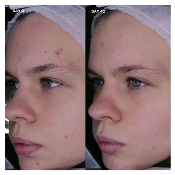 Відновлюючий крем для обличчя AMELIORATE Balancing Facial Moisturiser | Зображення 1