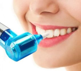 Відбілювач зубів Luma Smile Набір для відбілювання зубів