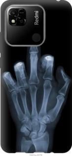 Чохол для Xiaomi Redmi 10A з пластику FCh_062613