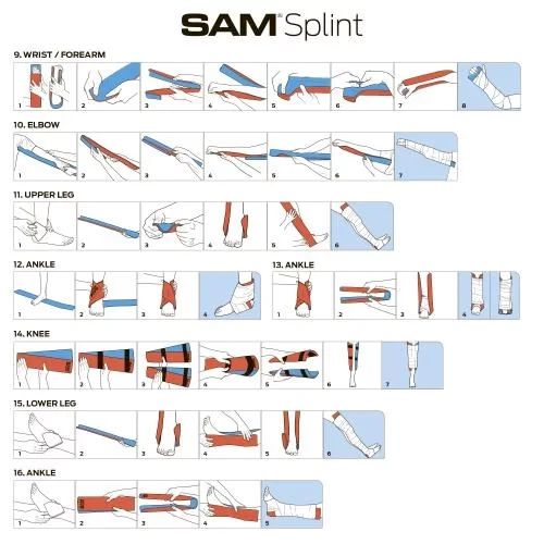 Іммобілізаційна шина SAM Splint 36" Rolled Медична універсальна шина  призначена для тимчасової фіксації переломів, вивихів | Зображення 5