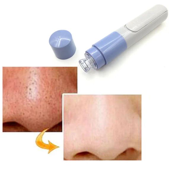 Вакуумный очиститель пор Pore Cleaner | Зображення 1
