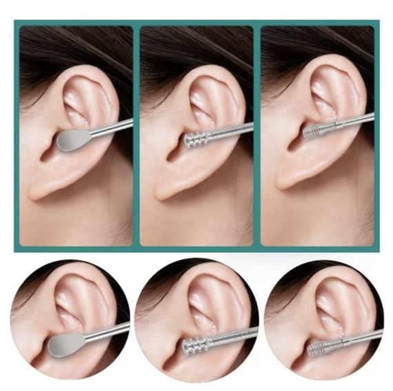 Набор для чистки ушей и удаления ушной серы из 6 инструментов. Желтый | Зображення 4