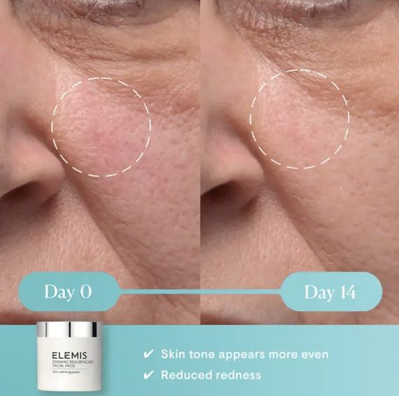 Відновлюючі диски для обличчя Elemis Dynamic Resurfacing Facial Pads 14 шт. | Зображення 4