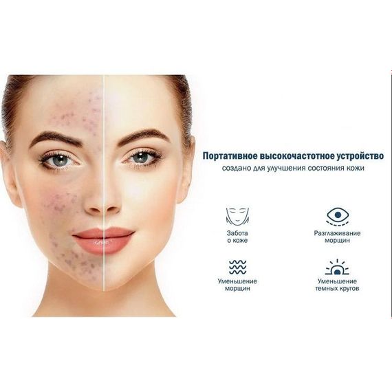 Портативная дарсонваль MEDICA+ DARSOLINE 7.0 гарантия 1 год | Зображення 3