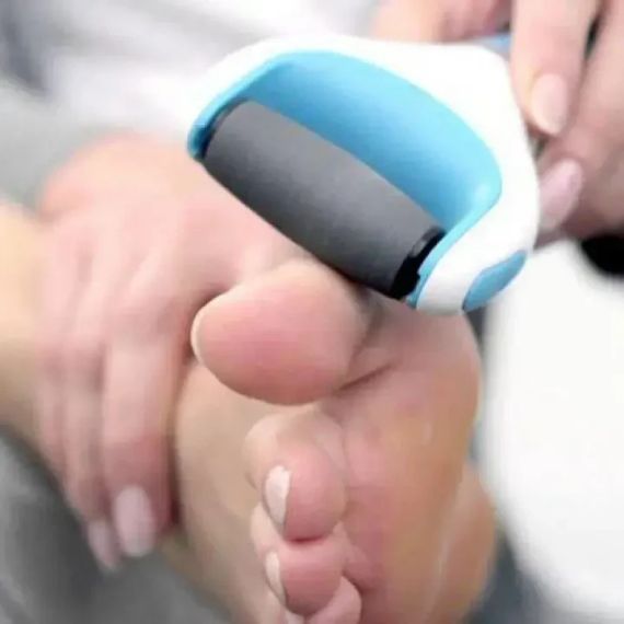 Электрическая пилка для ног Cordress Electric Callus Remover | Зображення 2