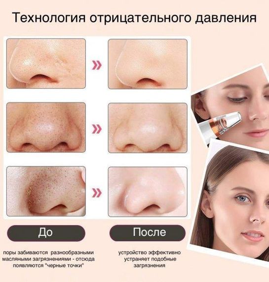 Вакуумний очищувач шкіри та пор Multi-Functional для чищення обличчя | Зображення 1