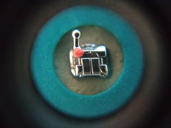 Passive SL FBLS 022 w/h 345, набор | Зображення 2