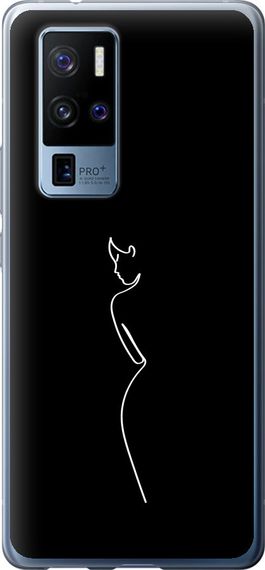 Чехол на Vivo X50 Pro Plus Силуэт1 "4590u-2056-17620"