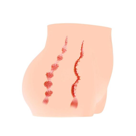 Мастурбатор-полуторс Kokos Cherry, два входа: вагина и попка sexstyle | Зображення 6