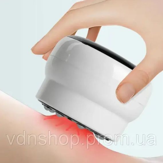 Антицелюлітний вакуумний масажер Intelligent Cupping Massage, акумуляторний ручний масажер для тіла Білий LY-873-White | Зображення 2
