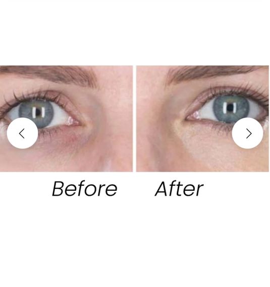 Антивікова сироватка консилер для очей Transformulas FlawLess EyeRetouch Serum 2 -IN - 1 ANTI-AGEING SMART | Зображення 1