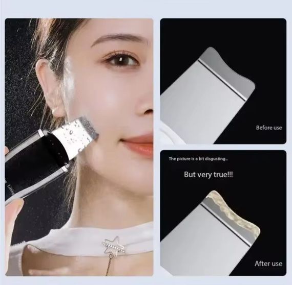 Ультразвуковой скрабер для глубокой очистки кожи с функцией EMS | Зображення 4