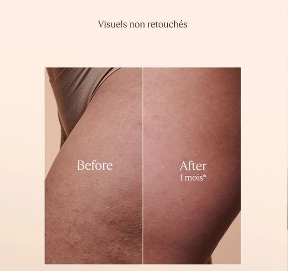 Олійка для тіла L'Occitane Huile Souplesse Amande 100 мл | Зображення 3