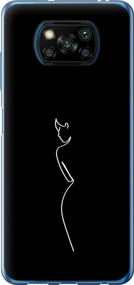 Чехол на Xiaomi Poco X3 Силуэт1 "4590u-2073-17620"