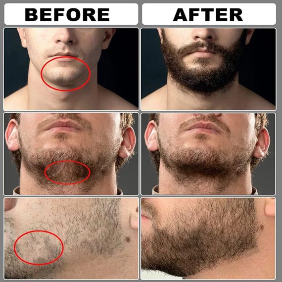 BeardCare Elite 8in1 — повний набір для росту, укладки та догляду за бородою | Зображення 8