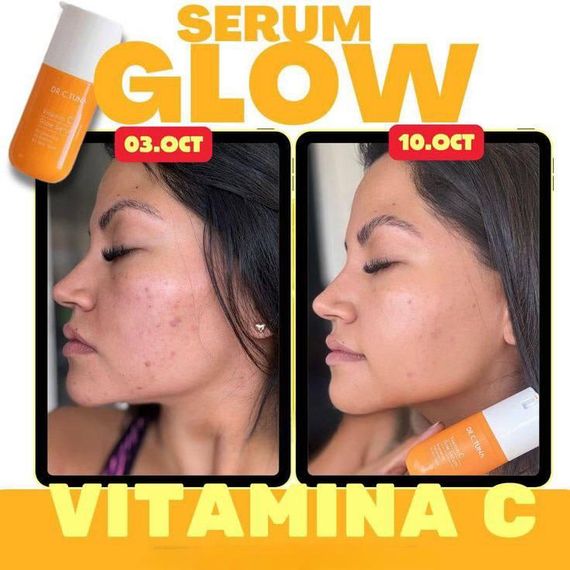 Сироватка для обличчя з вітаміном С Farmasi Dr. C. Tuna сяйво відбілювання зволоження 30 мл | Зображення 4