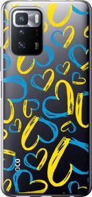 Чехол на Xiaomi Redmi Note 10 Pro 5G Сердца UA "5292u-3333-17620"