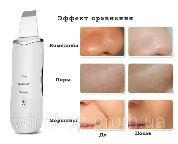 Аппарат для ультразвуковой чистки лица Ultrasonic Shovel | Зображення 1