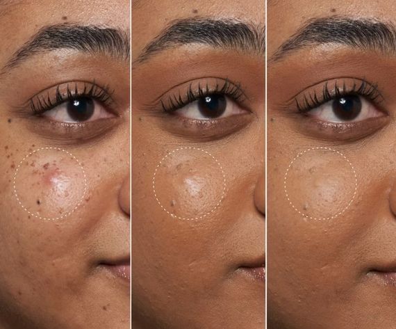 Крем гель для обличчя Fenty Skin Blemish Defeat’r BHA Spot-Targeting Gel 15 мл | Зображення 3