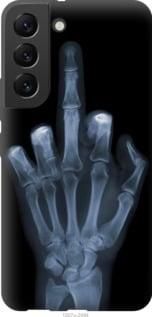 Чехол на Samsung Galaxy S22 Рука через рентген из силикона FCh_061954