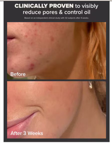 Щоденний ексфоліант paula’s choice 2% bha liquid exfoliant | Зображення 4