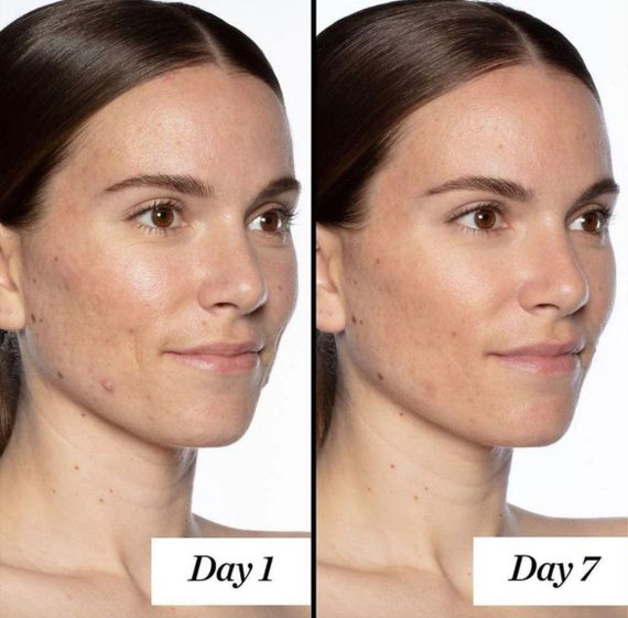 Сироватка для оновлення шкіри з гліколевою кислотою Sunday Riley Good Genes Glycolic Acid Treatment 5 мл | Зображення 1