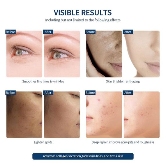 Бездротова LED маска для обличчя, 7 кольорів, антивіковий догляд, омолодження, відбілювання шкіри, 270 LED | Зображення 3