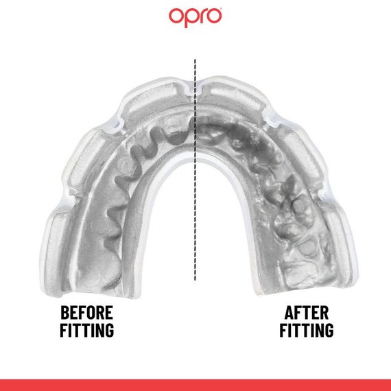 Капа OPRO Instant Single Colour Braces доросла (вік 11+) Clear (art.102522007) | Зображення 3