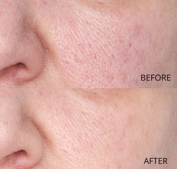 Сироватка для шкіри обличчя Perricone MD Hypoallergenic Clean Correction Smoothing Restorative Serum | Зображення 3