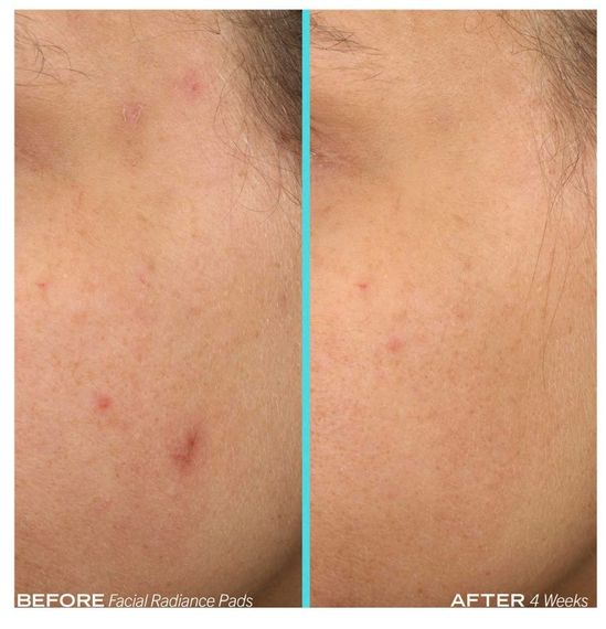 Вішлущувальні диски для обличчя First Aid Beauty Facial Radiance Pads with Glycolic + Lactic Acids 28 Pads | Зображення 2